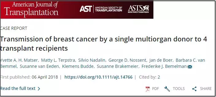好心办坏事？史上最牛乳腺癌，同时传染4个人