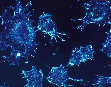 癌症发生需要多长时间？