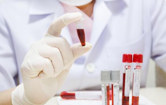 血样分析有助提高抗癌药试验效率