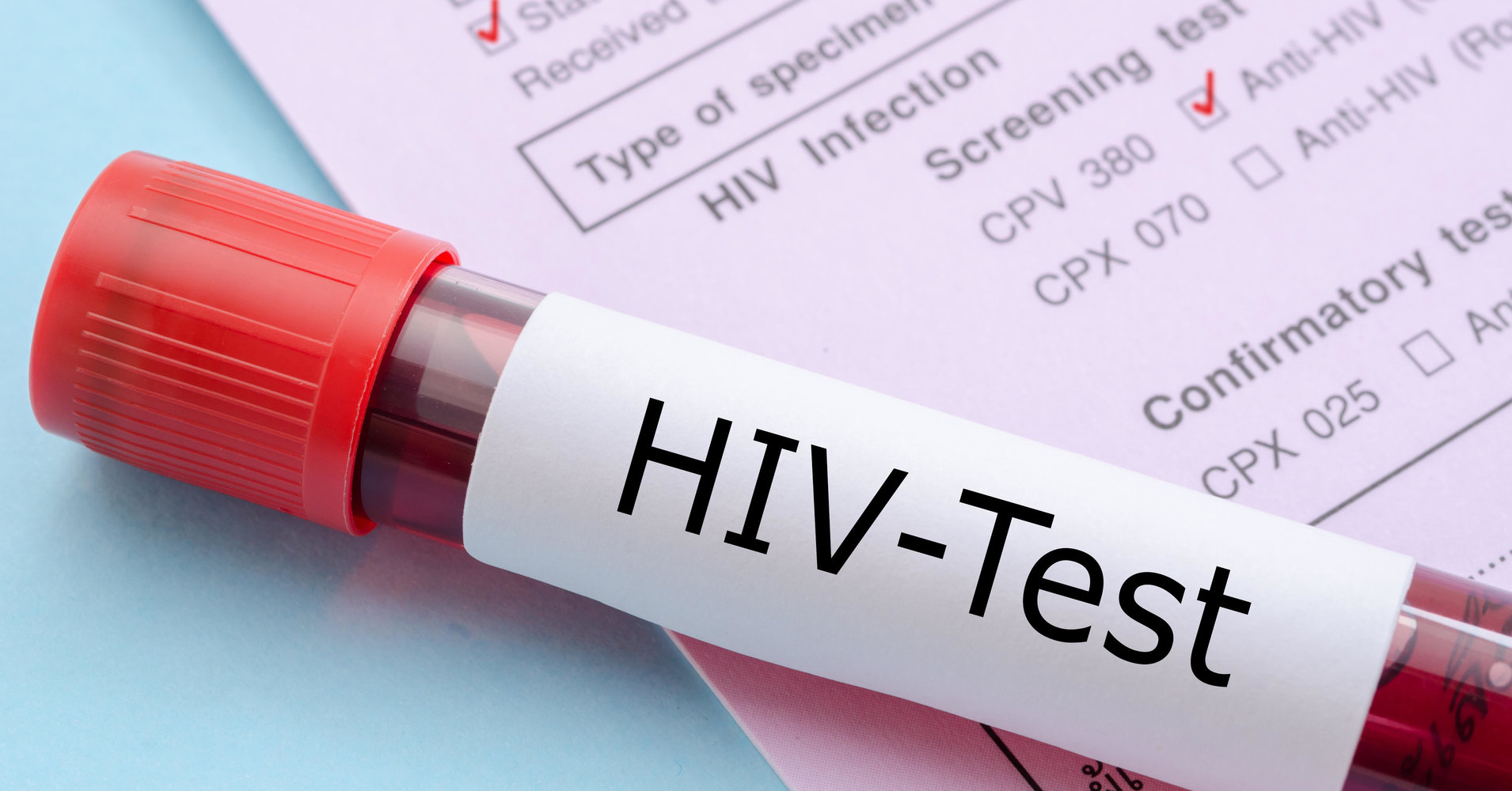 联合国艾滋病规划署： 抗逆转录病毒疗法能阻止HIV传播