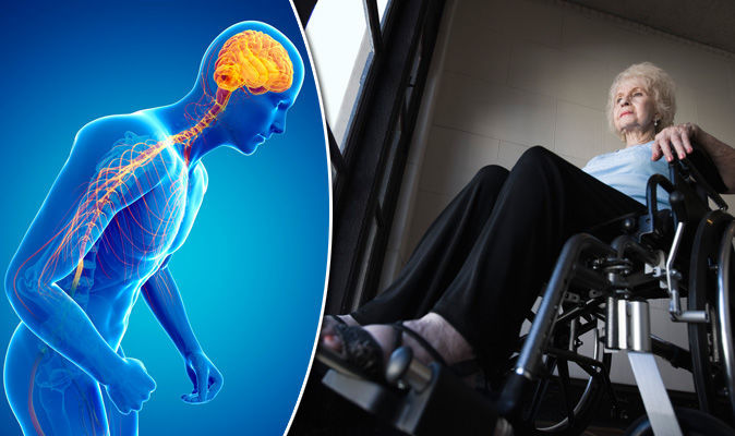 研究：切除阑尾者帕金森综合症发病风险或升高