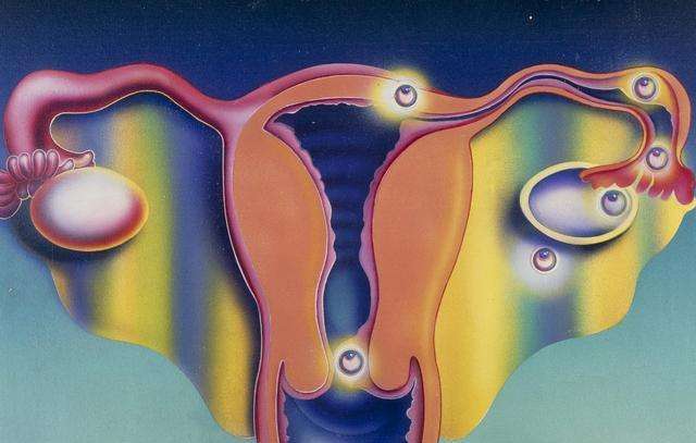 一文读懂输卵管异位妊娠的诊断与治疗