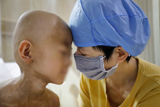 白血病病人的生死赌局：不得这病不会知道多痛苦