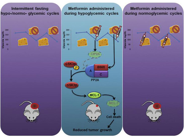 Cancer Cell：研究发现二甲双胍/禁食协同抑制肿瘤的生长