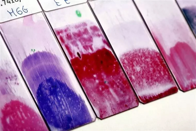 这位医生在妻子身上做了两年研究，挽救了数百万女性的生命