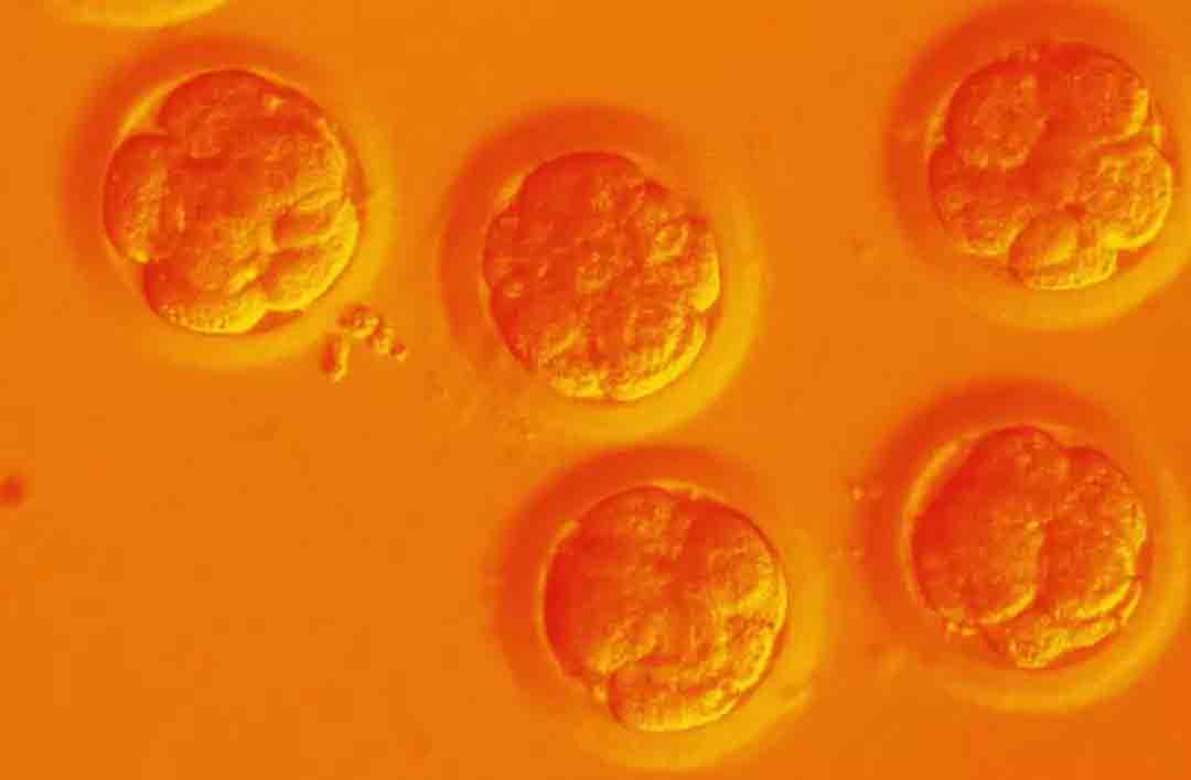 贺建奎实验的“致命”问题：基因编辑女婴未来或会折寿