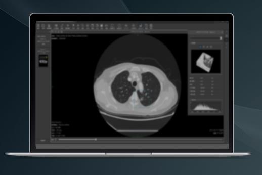 AI赋能医疗，深睿医疗完成数亿元C轮融资