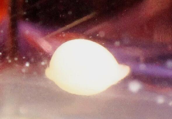 日本“迷你器官”研究走向临床试验