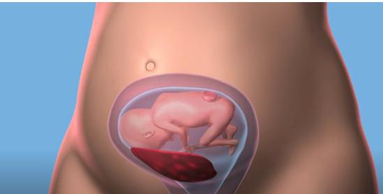 全球著名医疗机构完成首例宫内胎儿手术