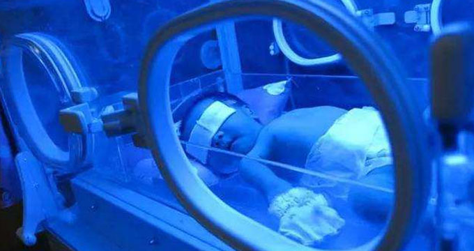 一文读懂新生儿高胆红素血症的诊断与治疗