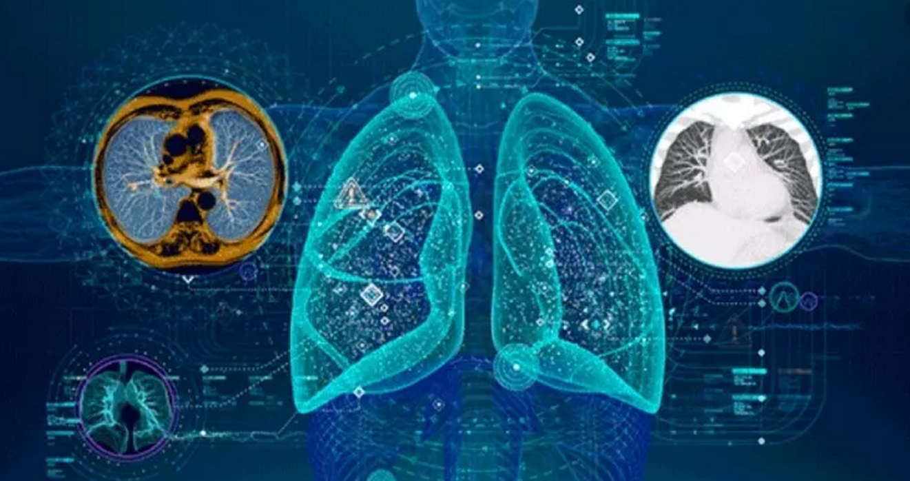 有临智能肿瘤影像评估系统专家咨询会顺利召开