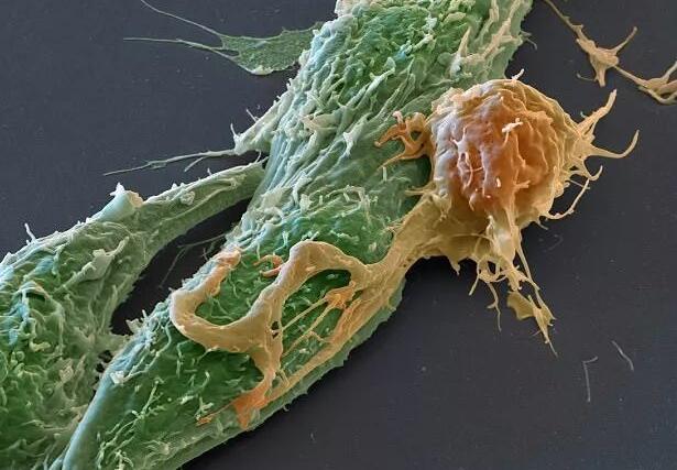 布局国际市场，传奇生物或涉足下一代骨髓瘤产品