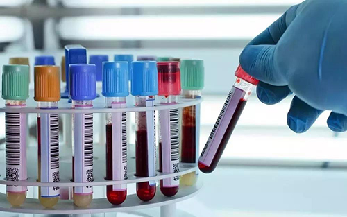 膀胱癌液体活检的研究进展