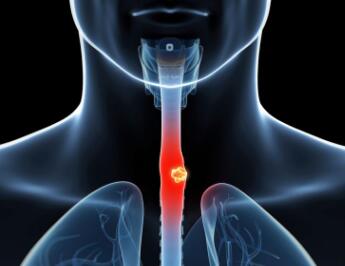 恒瑞发布卡瑞利珠单抗新研究结果，食管癌或将有免疫疗法