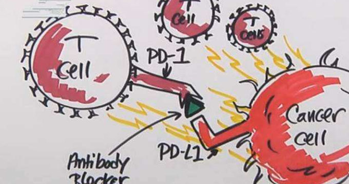 最贵国产PD-1慈善赠药政策公布：买2赠2再买4赠至一年