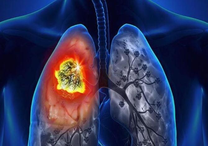 2019上半年EGFR和ALK肺癌靶向药物市场情况分析