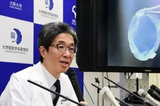 日本实施全球首例iPS细胞角膜移植手术