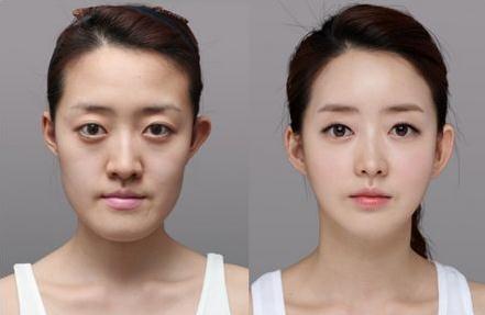 从新氧、更美到美团医美、阿里健康，医美的千亿市场流量之争