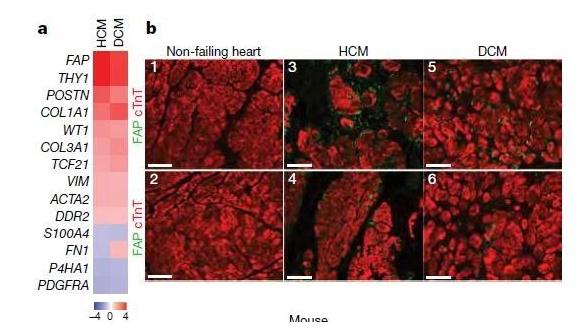 首开先河！明星抗癌疗法CAR-T还能治疗心脏病