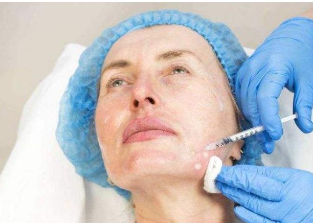 暴利玻尿酸：成本19元，打到脸上3800元