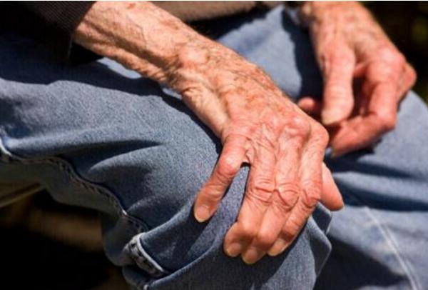 新研究确定与帕金森病发生有关的遗传标志