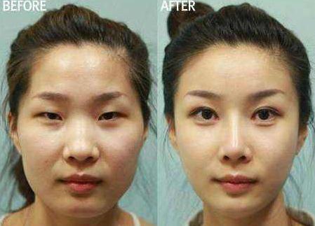 医美机构“流量思维” 割韭菜的骗子模式难以为继