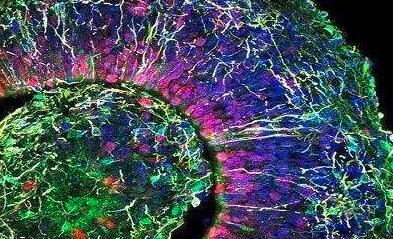 日本iPS细胞研究新突破，可同时培育3种迷你器官