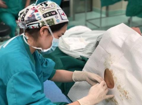 无痛分娩，革命尚未成功