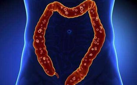 从不治之症到对“基因”下药：结直肠癌百年寻因路