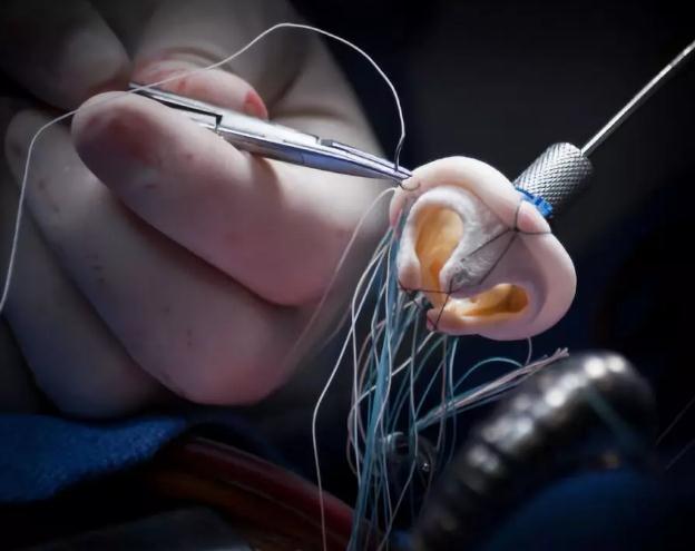 克利夫兰诊所发布“2020年十大医疗创新”