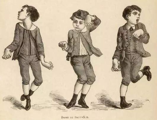 复旦研究团队为无法治愈的神经疾病带来新曙光