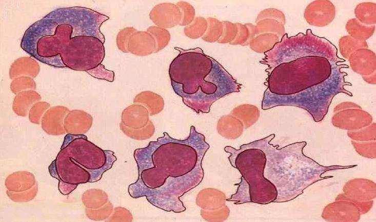 金斯瑞子公司传奇生物发布CAR-T细胞制剂治疗多发性骨髓瘤的研究数据