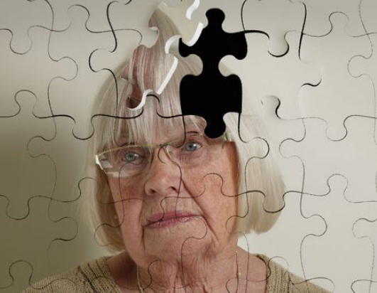 干细胞治疗阿尔兹海默症的现状及展望