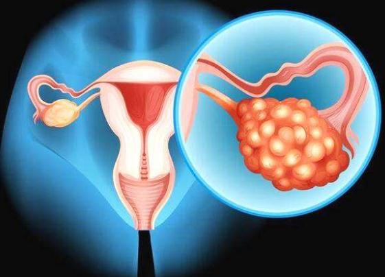 中国首个！利普卓获批用于BRCA突变晚期卵巢癌一线维持治疗