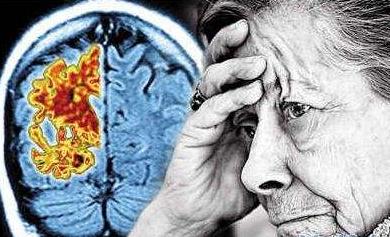 “起死回生”的阿尔茨海默病新药的详细数据该怎么理解？