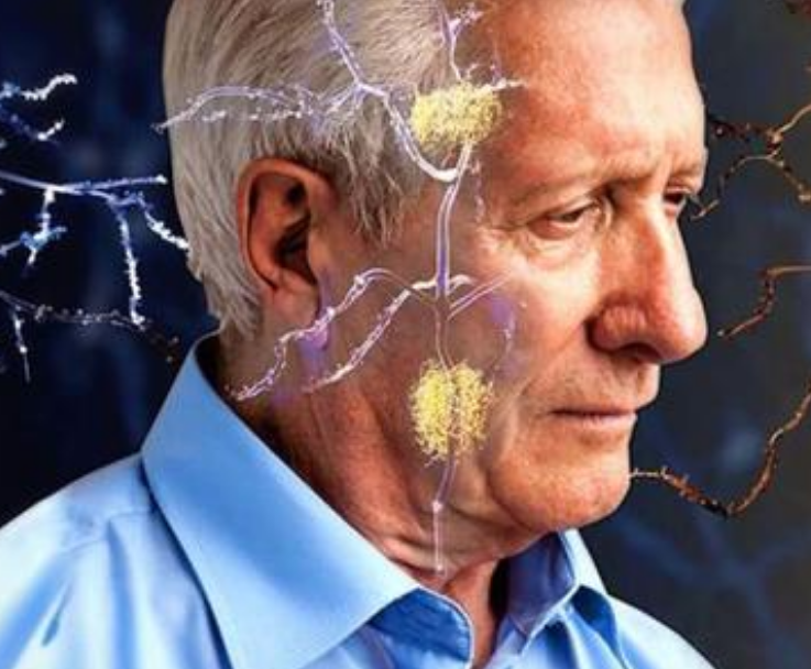 阿尔茨海默症新靶点——MSUT2