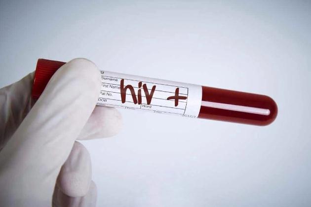 GSK长效HIV注射剂遭FDA拒绝