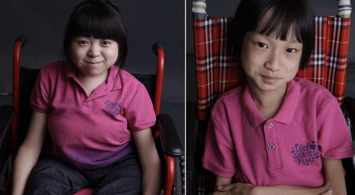 2019年中国批准上市的罕见病新药物盘点