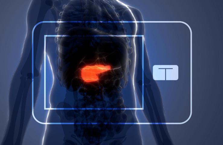 无需再手动监测血糖和频繁注射胰岛素，人造胰腺获批