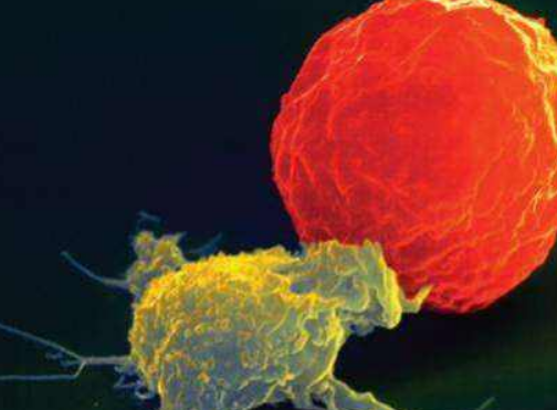 NEJM重磅：脐带血衍生的IL-15“装甲”CAR-NK疗法治疗CD19阳性淋巴瘤达73%的缓解率