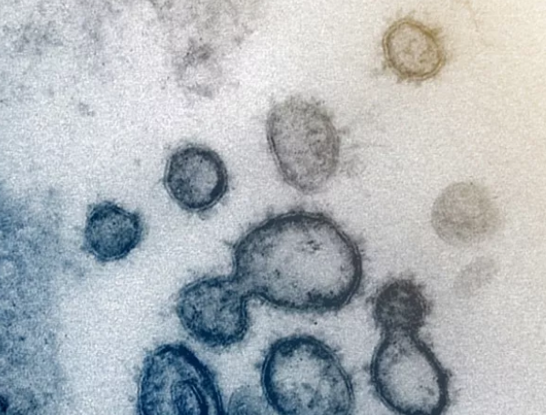 最新进展：新冠病毒S蛋白与细胞ACE2的亲和力是SARS的10到20倍