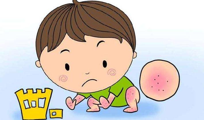 克立硼罗软膏（2%）儿童特应性皮炎扩展适应症补充申请获FDA批准