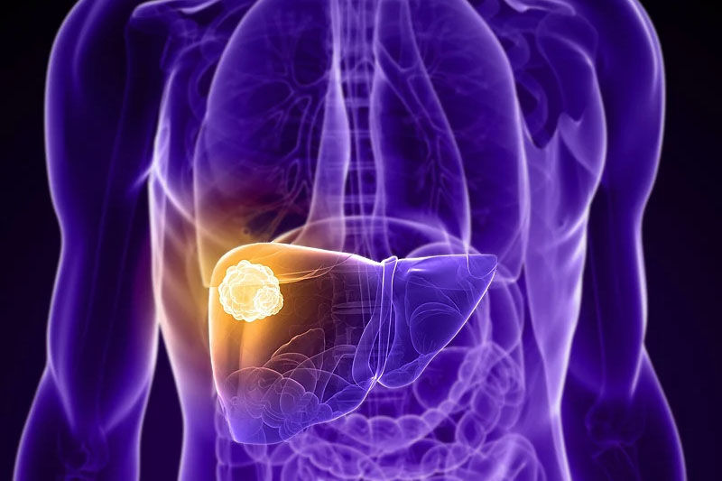 抗衰老药物，或能治疗肝癌