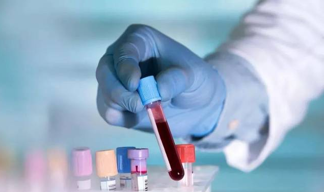 中国1.7万人血清检测结果公布，普通人群感染率不到1%