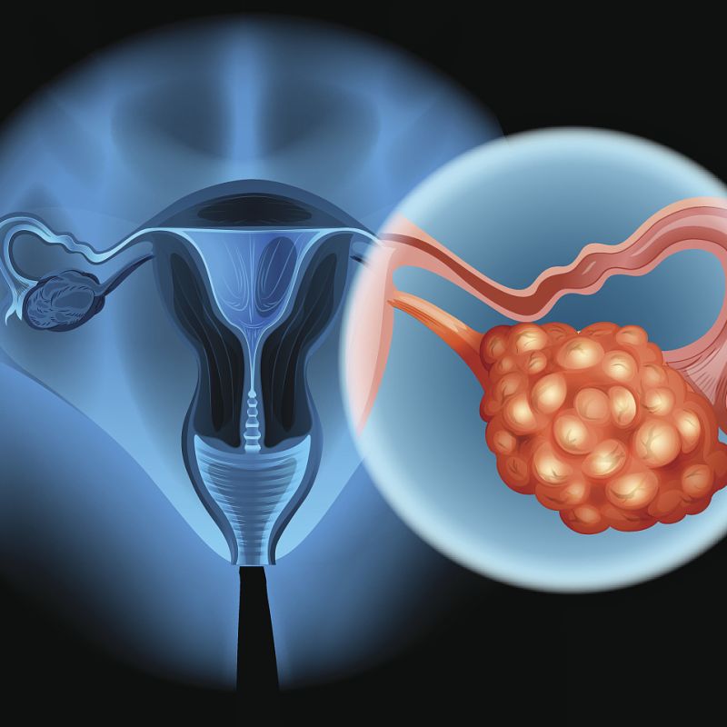 重磅！百济神州第三款自主研发的抗癌新药PARP抑制剂帕米帕利正式获批 