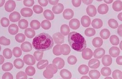 阿伐替尼海外获批新适应症，基石药业拥有大中华区权益