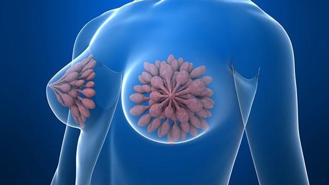礼来乳腺癌新药唯择(阿贝西利片)成为唯一列入2021年国家医保目录的CDK4&6抑制剂