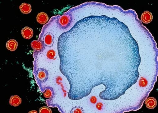 Science：高毒力HIV变异毒株出现，传染性、危险性激增