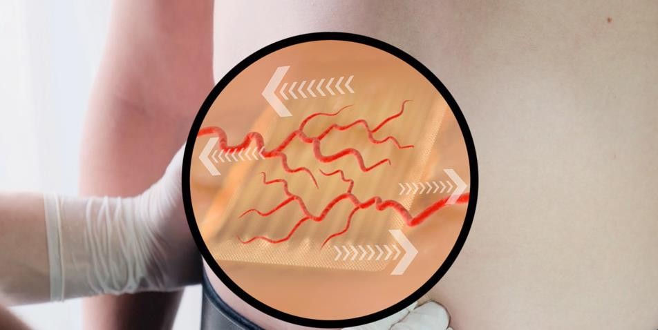 脱离胰岛素治疗2年以上，糖尿病新疗法来了