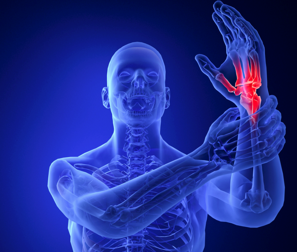 弥漫性腱鞘巨细胞瘤治疗亟需创新疗法    国内首个自主研发CSF-1R抑制剂获突破性疗法认定